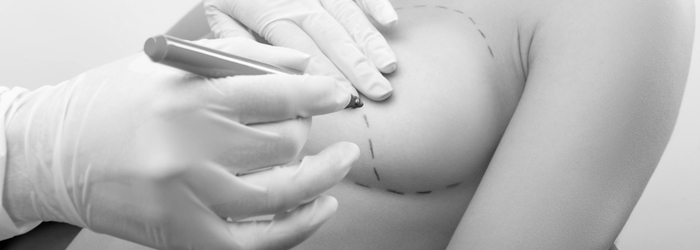 Lipofilling Borst