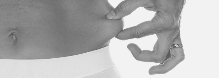 Buikwandcorrectie - Abdominoplastie